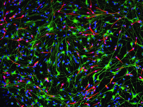 Discussion Workshop: Stem Cells – 6th May 2011