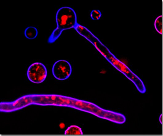 Host-fungal interactions: pathogenicity versus immunity – 21st October 2011