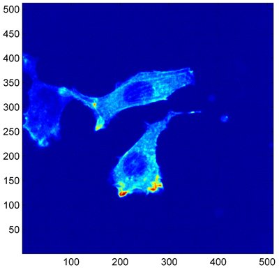 Discussion Workshop: Imaging Cell Migration in 3D-25th Nov 2011