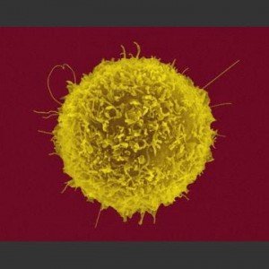 Analysing and moderating the function of regulatory cells in autoimmunity