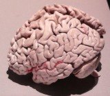 747px-Plastination_Brain_Alzheimer