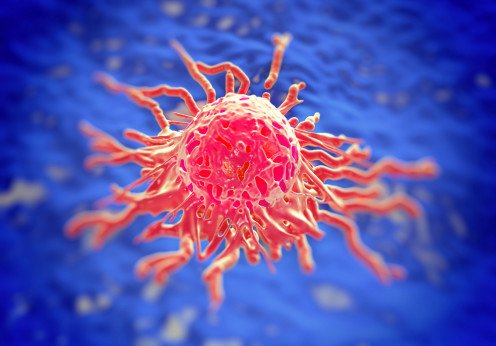 Cancer Pathology 2017 Image