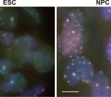 Heterochromatin_structure_in_ES_cells.