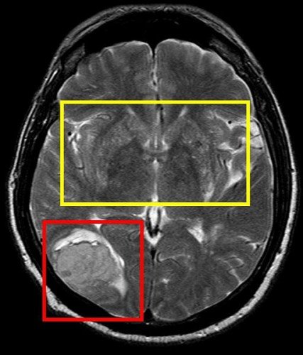 Hypertension2015IMAGE