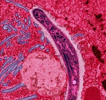 Malaria