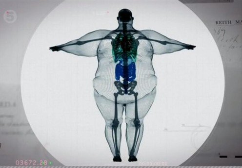The 2016 Obesity Summit