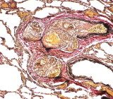 PathologyImage2015